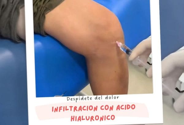 Ácido Hialurónico